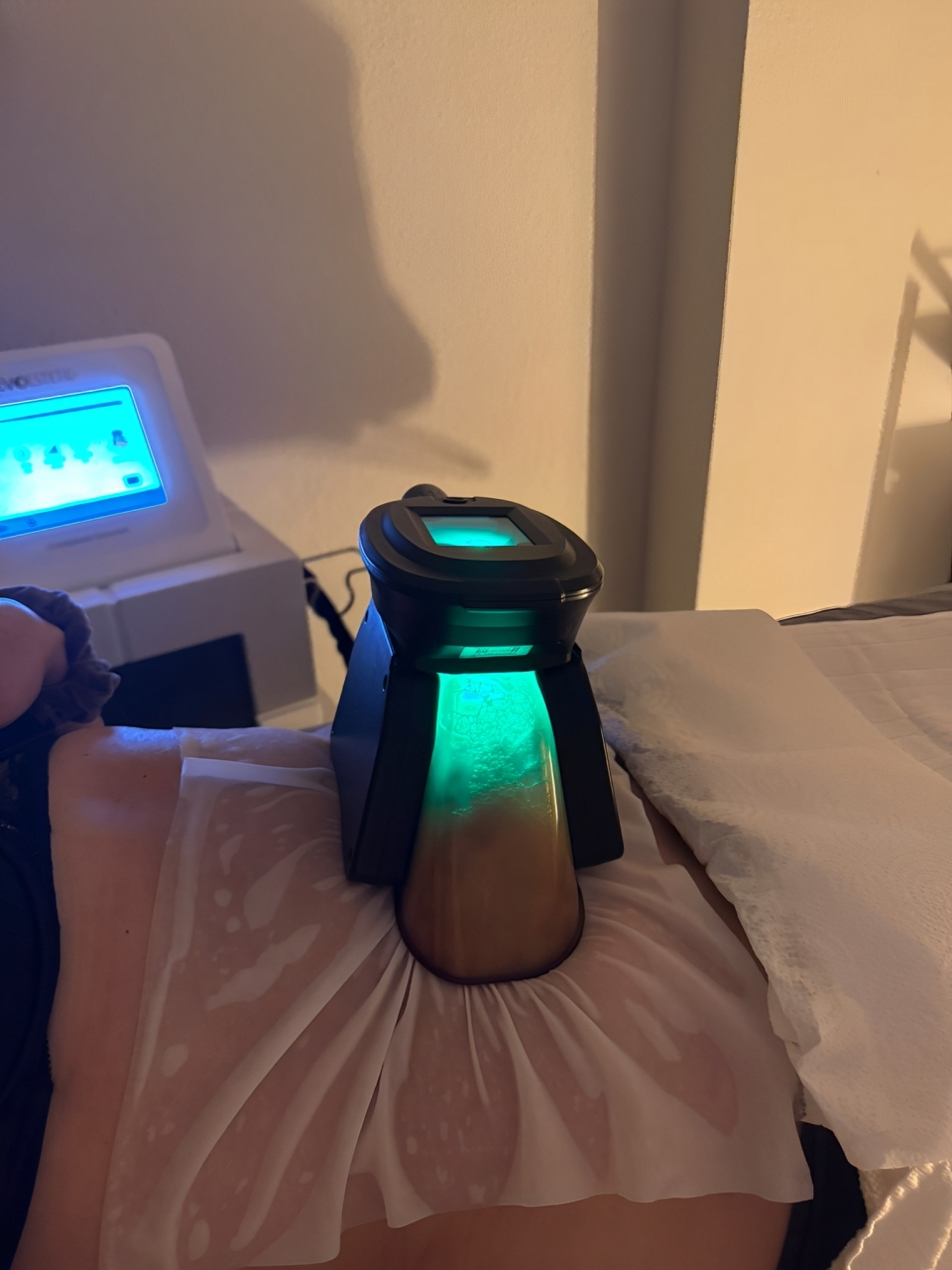 Equipamento de Criolipólise em Portugal