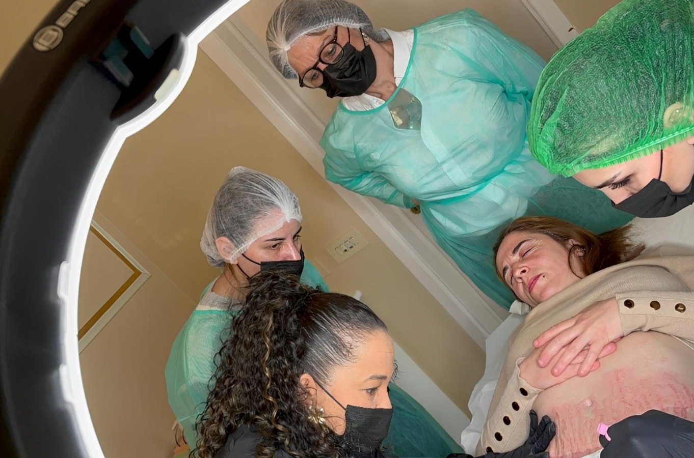 Formação profissional Microrenova para cicatrizes